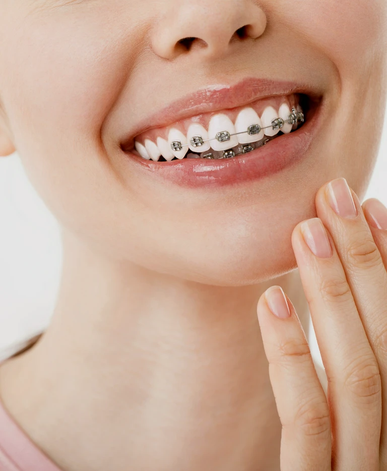 Uśmiechnięta kobieta z&nbsp;aparatem na&nbsp;zębach